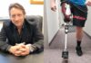 Getting a New Leg Up on Life: Dr. Bugg’s Prosthetics Include Legs, Feet, Braces…and SMILES GETTING A (NEW) LEG UP ON LIFE